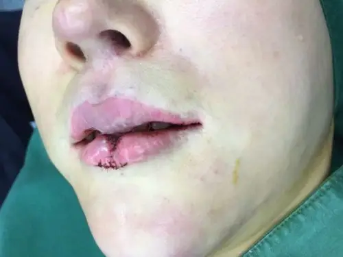 !doctype html>  html>  head>  me