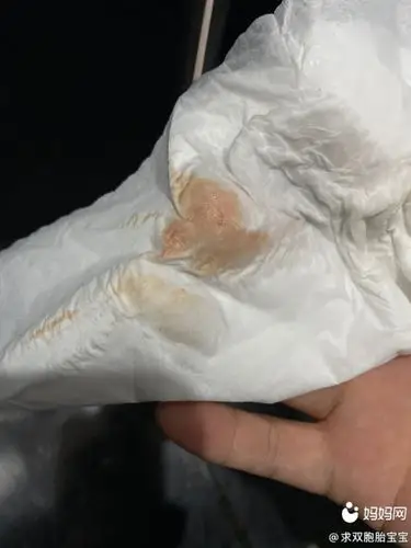 5月29排卵同房,排卵第8天有出血