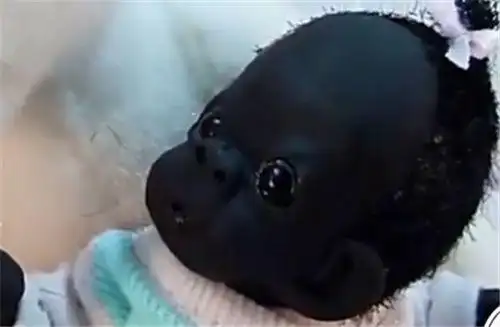 刚出生就被定为世界最黑的婴儿5年过去了如今变白了吗