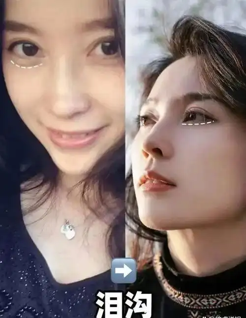 从小美女到大美人,森林北的颜值逆袭技术攻略