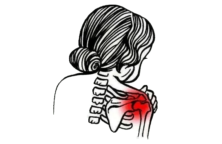 典型案例肩膀痛就是肩周炎no关节与运动医学科专家教你三招辨别肩痛