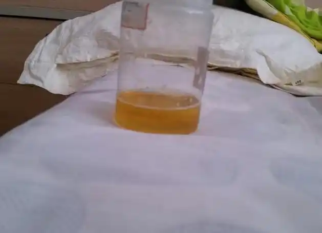 排尿时,尿液颜色很黄,还有一股异味,和哪些原因有关?