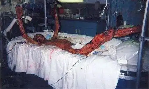 两次轰动全世界的核事故过去是人间炼狱如今是荒凉鬼城