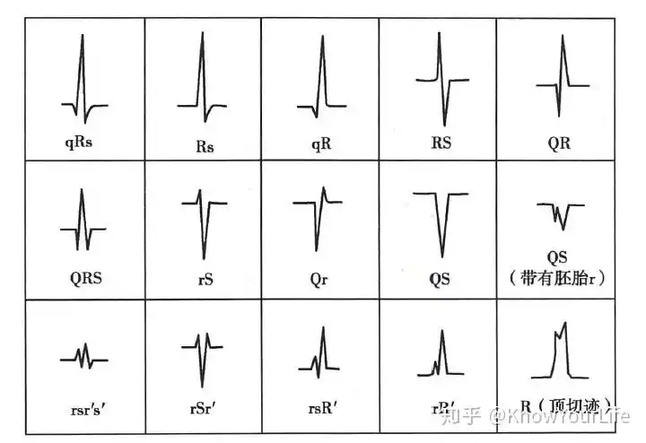史上最全医学科普7心电图怎么看
