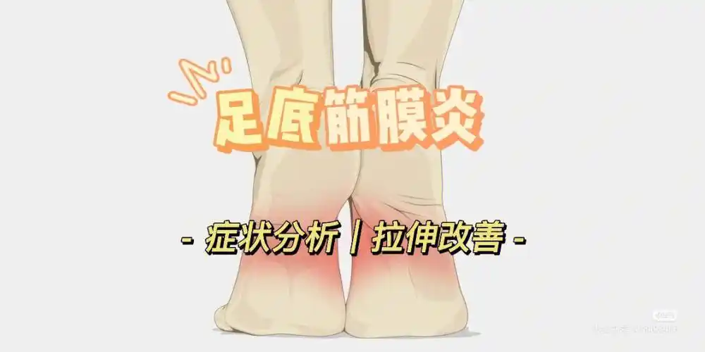 下床踩地脚就痛714个动作改善足底筋膜炎75