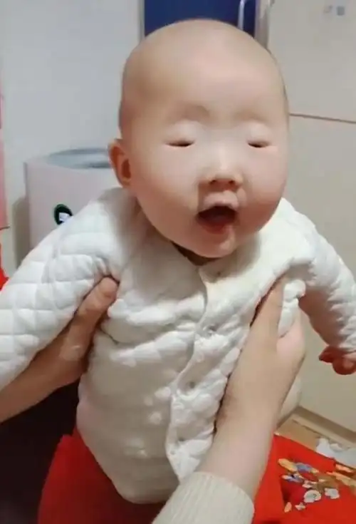 孩子的眼睛大小由什么决定?