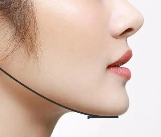 下颚线是什么意思 - 逸致生活