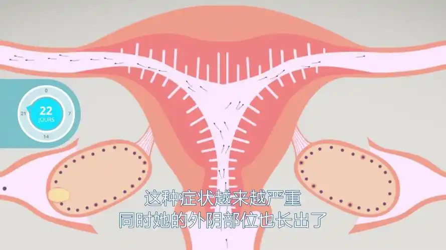 女大学生患上"外阴癌",医生告诫:可能与这1事有关,别忽视-健康视频