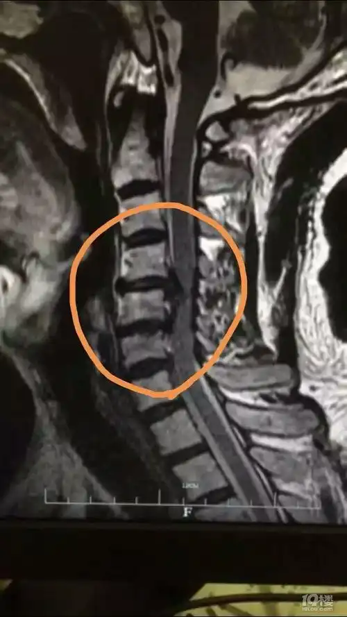 坐火车一路睡到杭州,他下车发现问题严重了!小便都解不出了