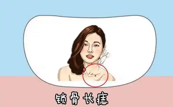 锁骨下方有痣的女人图解女人锁骨下方有痣好不好