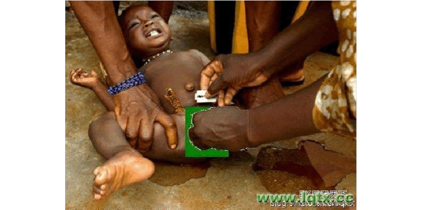 揭秘让1.5亿少女受害的"割礼"恶俗