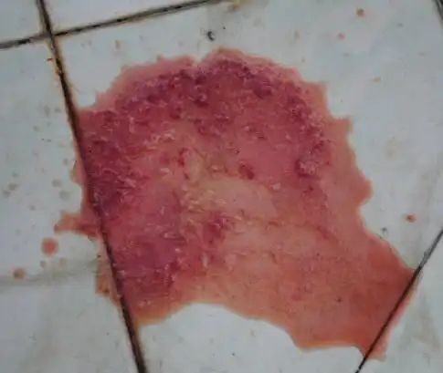 10个月泰迪拉稀拉血吐了,胃炎是一个漫长的恢复过程啊