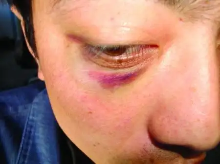 安阳一男子手术后死在医院 家属讨说法遭围殴受伤