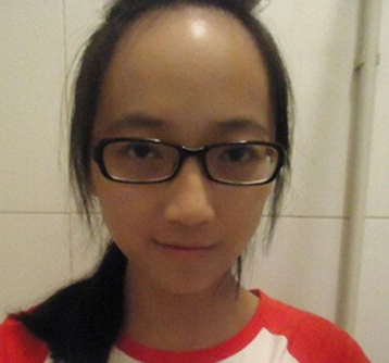 我的发际线高吗?