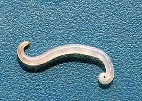 3岁男孩总是"掏裆",妈妈发现不对劲,检查后才知是"蛲虫病"