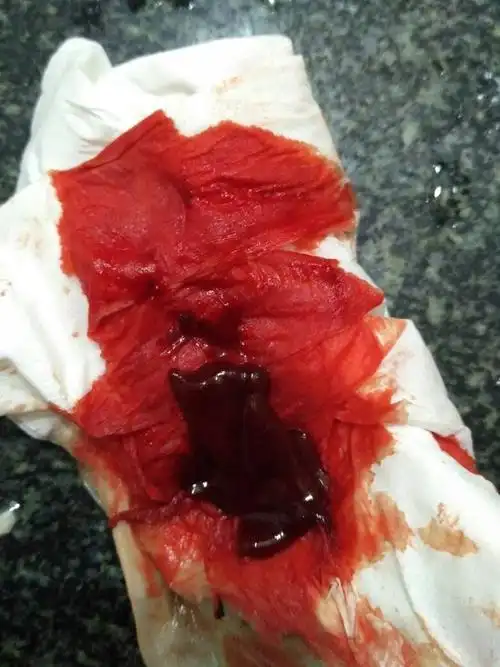 女生卫生巾上的血,新鲜的带血的卫生巾-图片大观-奇异网