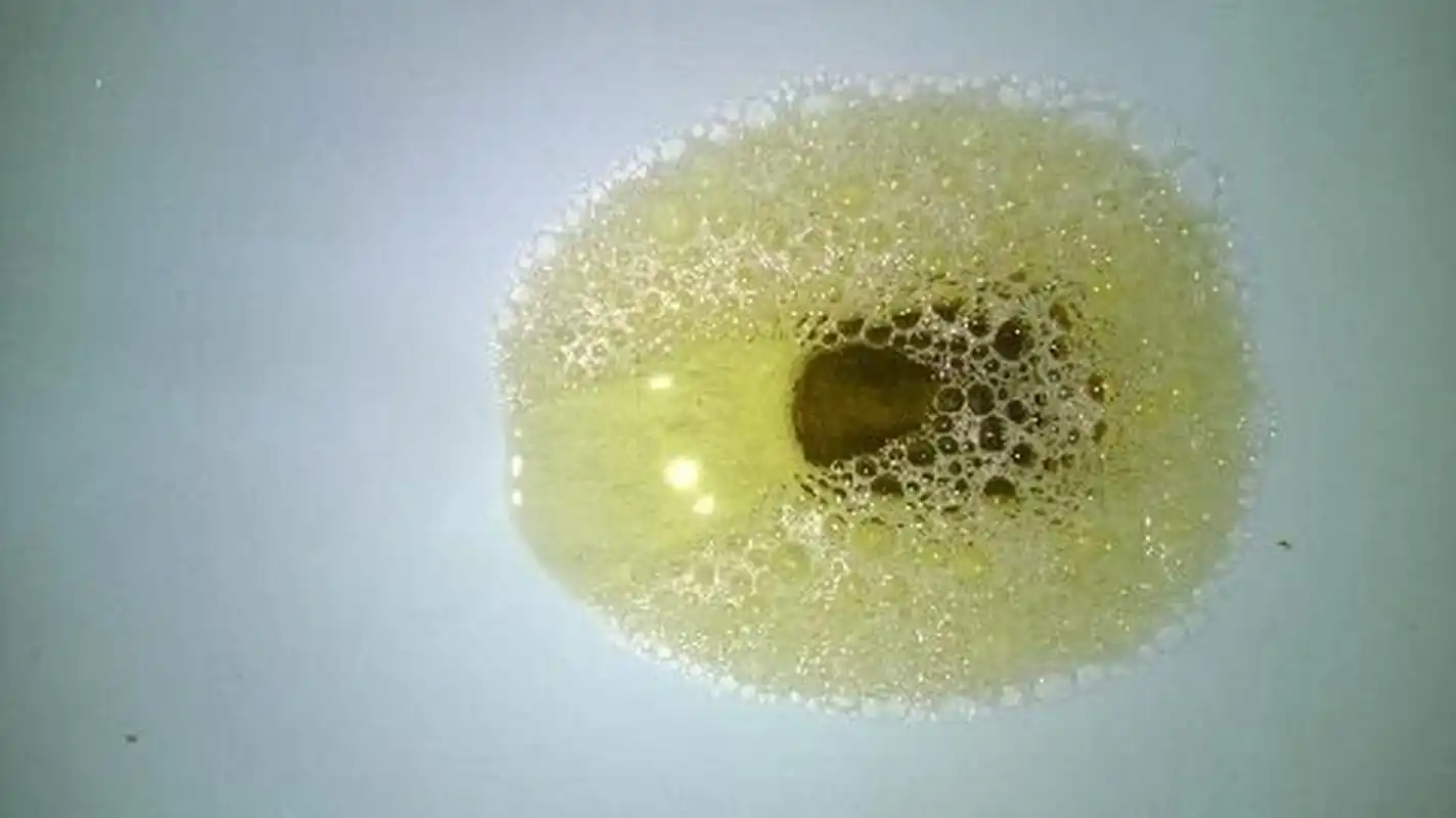 尿液产生泡沫的原因主要是尿液中出现了一些有机物质和无机物质使