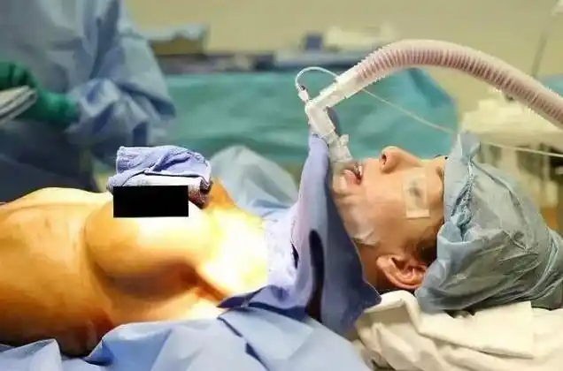 实拍丰胸手术全过程 看完你还敢动吗?(组图)