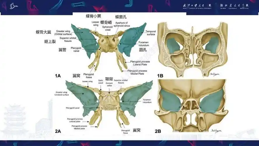 蝶骨大翼病变影像诊断_流程_关怀_服务