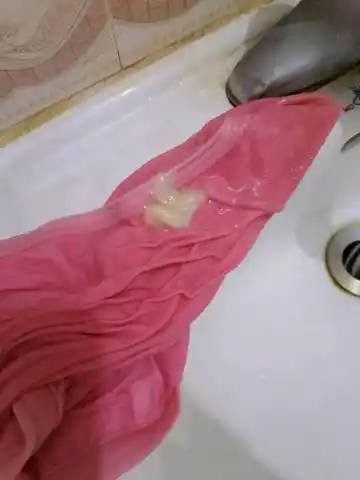 育儿问答 怀孕期 38周加了,一下子流出这样的东西还伴有点水,是不是