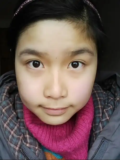 婴儿肥脸型,白皮肤,大眼睛,短额头的17岁女生适合齐刘海吗?