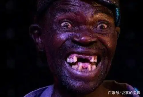 世界上最丑的人,5次选丑4次冠军,引起愤怒,联名抗议他参赛!