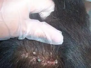 虱子怎么去除?去虱子和虱子卵的有效方法