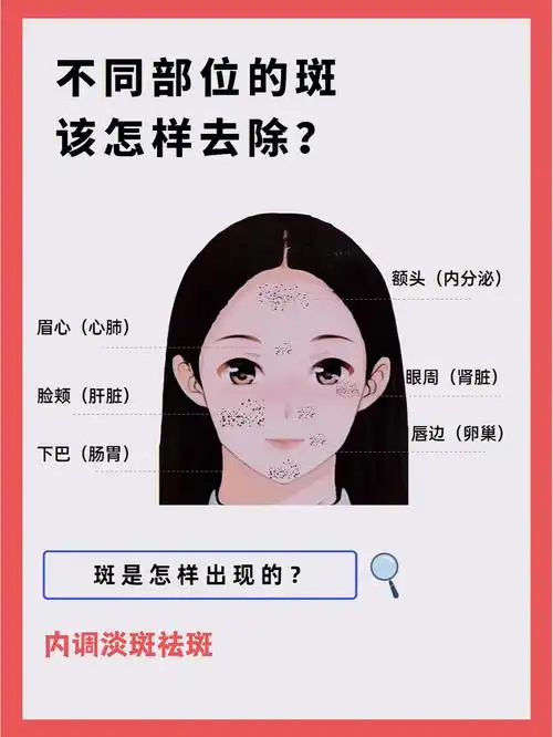 眉心长斑(心肺)眼周长斑(肾脏)脸颊长斑(肝脏)唇边长斑(卵巢)下巴长