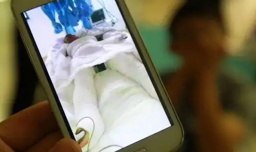 全身裹满绷带的伤者.