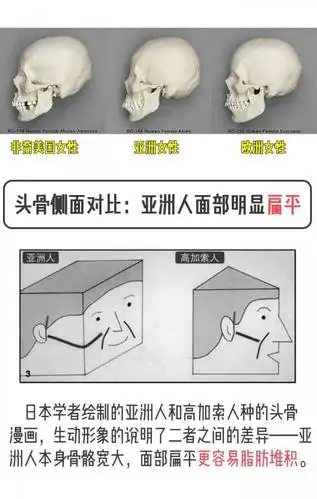 人家显胖 ② 亚洲人天生皮下脂肪层要比欧美人厚,因为欧美人骨骼立体