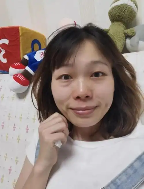 40岁女人的眼纹怎么办?45岁的女人眼袋越来越明显