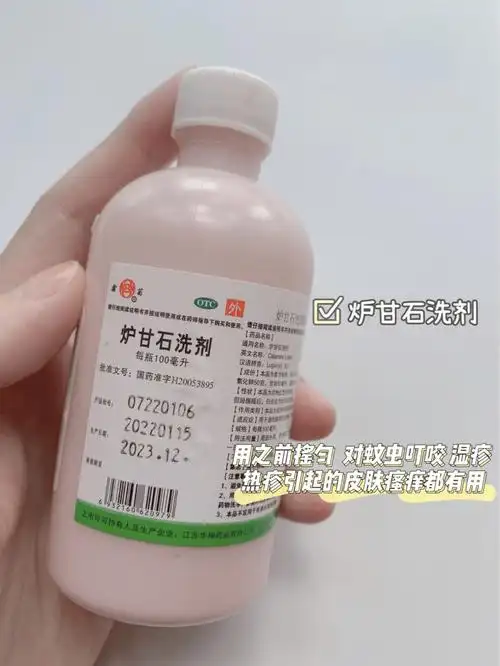 万能的炉甘石洗剂新手麻麻必备神器