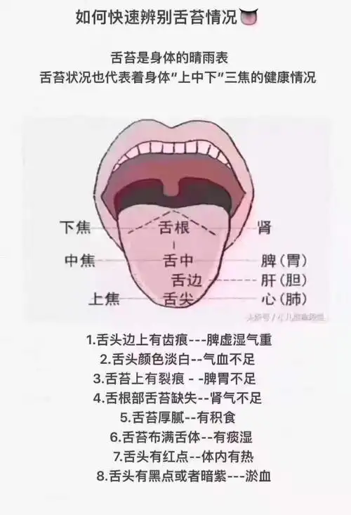 教你看小儿舌苔辨别问题所在