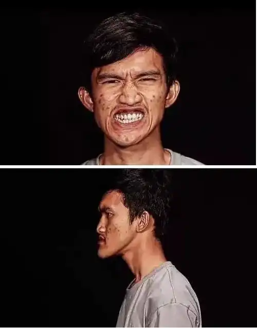 他,一脸痘痘就不说了 鞋拔子脸,女生一看就不喜欢! 他曾