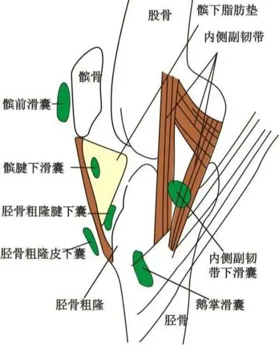 滑膜囊肿,腱鞘囊肿,滑囊囊肿一家亲?