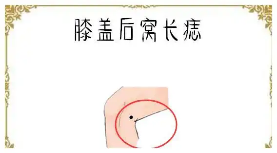 膝盖后窝长痣通常长在膝盖后窝位置的痣很难可以看得生肖性格出来