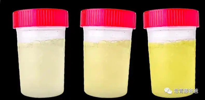 看尿知娃病7款尿液色号研究报告吃饭时不要点开
