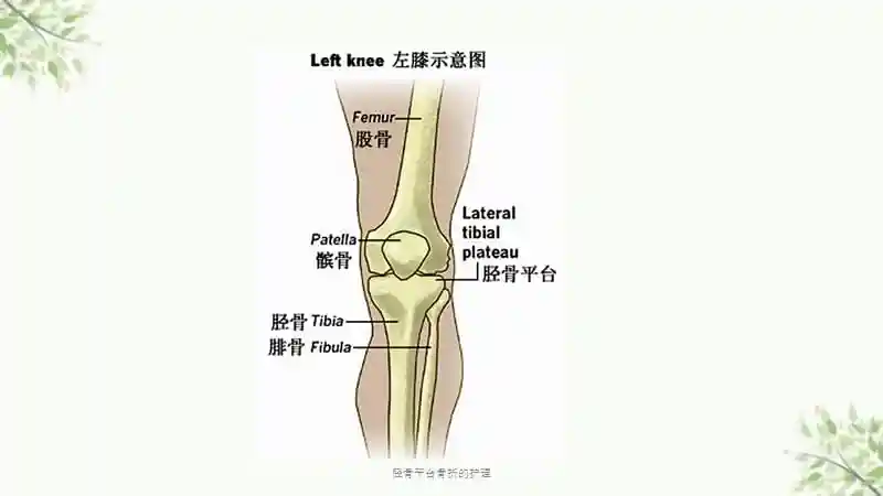 胫骨平台骨折的护理课件