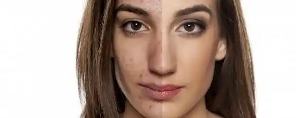 肤色偏黑黄穿什么颜色 黄黑皮肤适合穿什么颜色的衣服