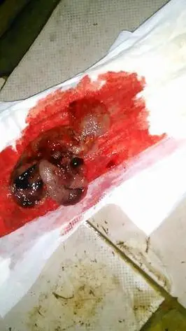 一般在孕5周(35天)左右可以在宫腔内看到孕囊,但是由于着床早晚问题