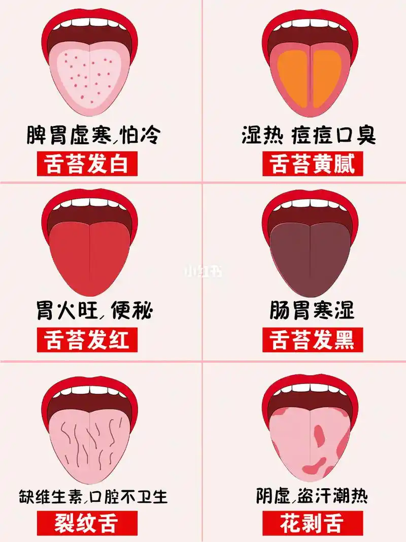 从舌苔颜色看身体健康状况7515痘痘99湿气99口