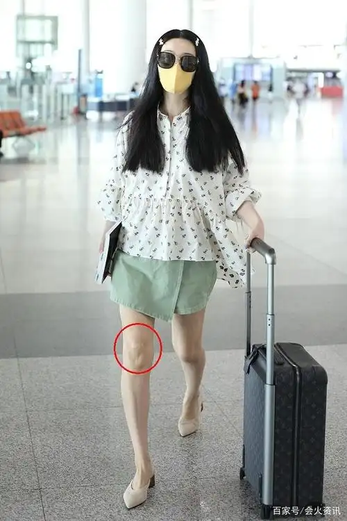 范冰冰穿清新绿裙大秀白皙美腿,看到膝盖后:让人心疼