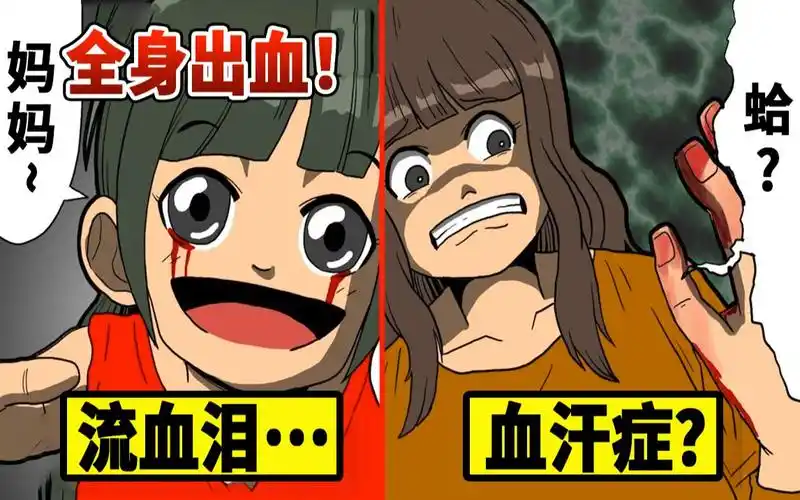 眼睛流"血汗症"…全世界仅有18例极为罕见的疾病_哔哩哔哩_bilibili