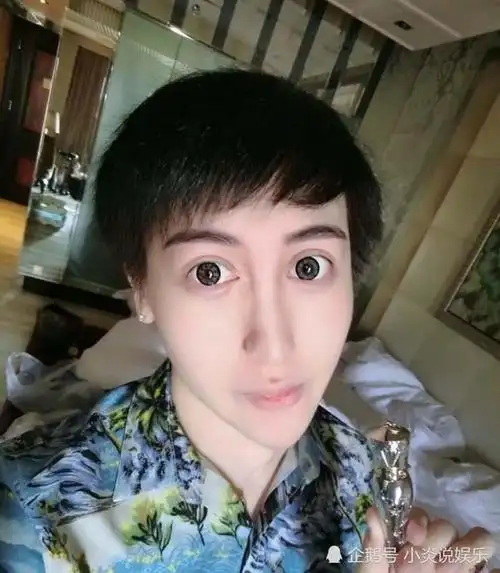 网红里整容太夸张的三位刘锌晨的锥子脸姚东霓的人体艺术