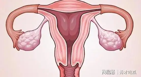 女人要保护子宫,就得做好这5件事,可不能大意|内膜|尿道|异位症|子宫