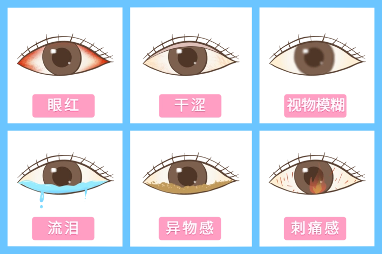 眼睛又干又痒小心干眼症