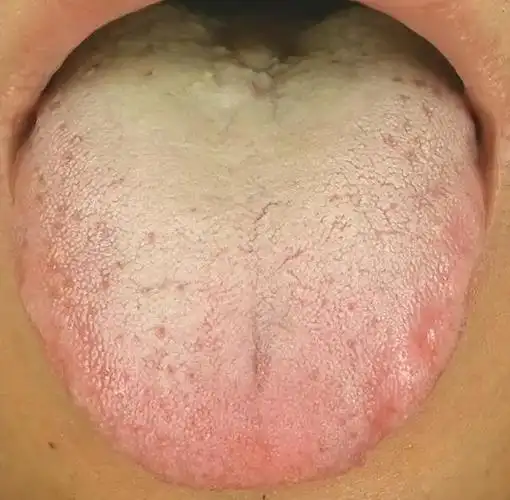 人体"照妖镜",看舌头就能分辨7种体质!看看你是哪一种?