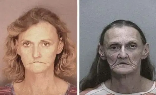 摄影告诉你吸毒对人的影响有多大前后恐怖对照