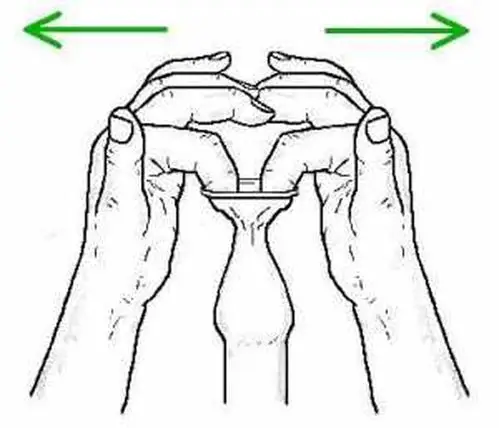 不想割包皮戴阻复环能达到割包皮的效果吗