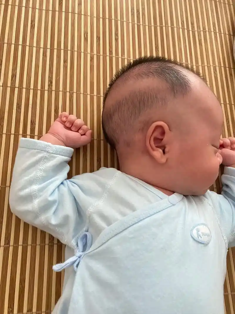 成功逆袭小圆头——舟状头怎么睡.图一:月子里,被月嫂带出舟状 - 抖音